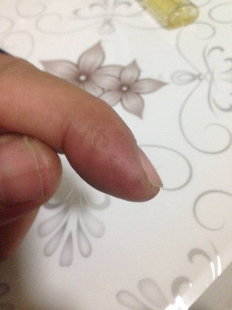 晚上有打一下，现在有点肿。。。
